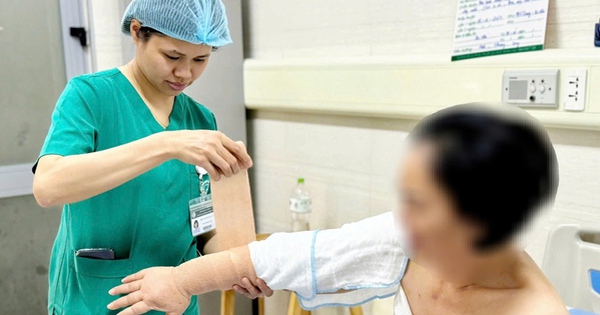 Reducción de brazo en paciente con linfedema, médico señala signos fácilmente reconocibles de la enfermedad