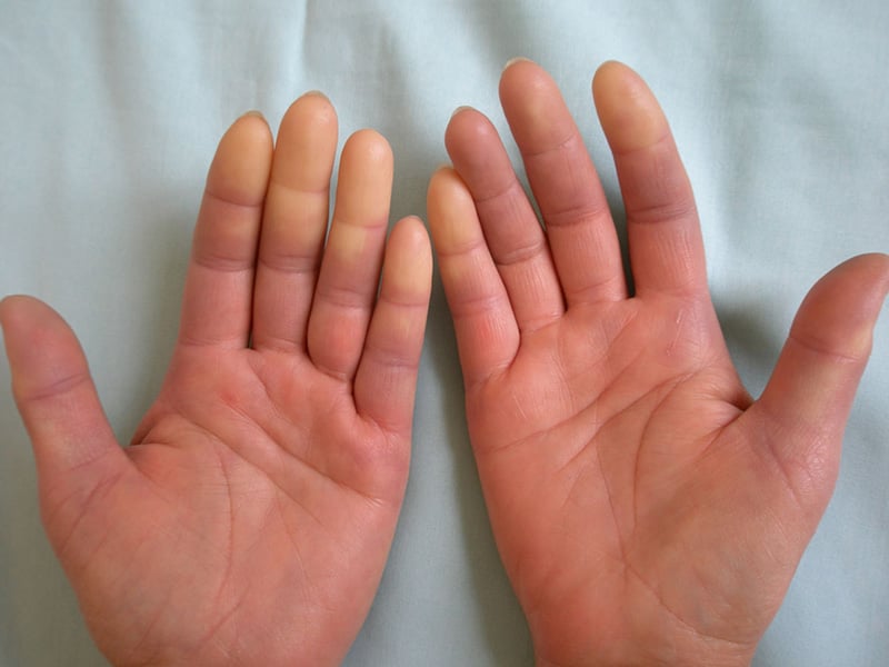 Trong điều kiện lạnh giá thì việc giữ ấm bàn chân, bàn tay là quan trọng. Ảnh minh hoạ