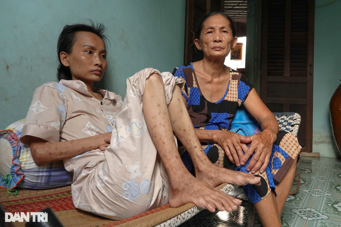 Góa phụ mắc bệnh nan y 