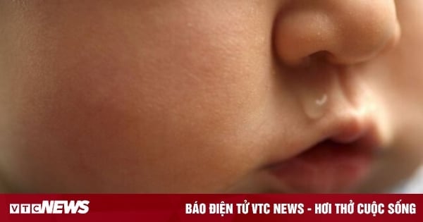 Baby hat laufende Nase - ein Symptom vieler Krankheiten, Eltern sollten nicht subjektiv sein