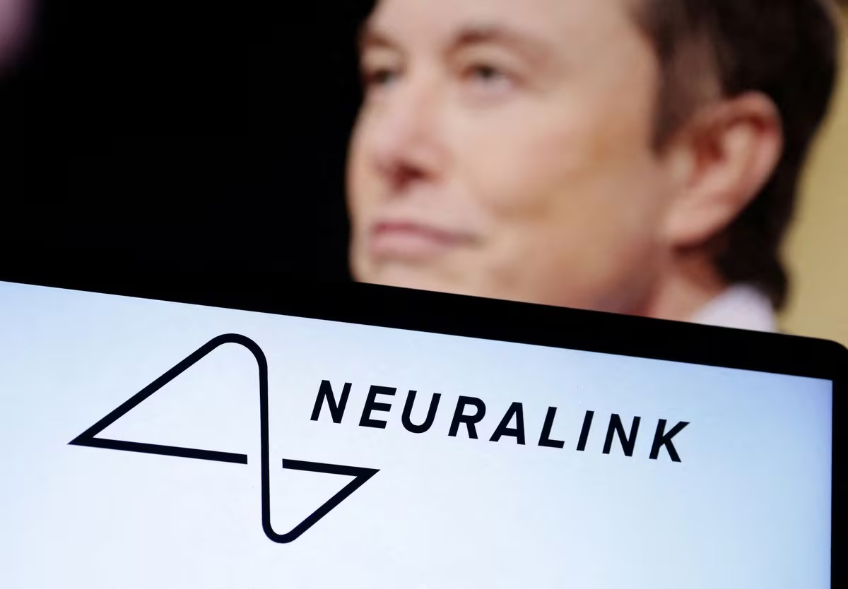 ty phu musk noi neuralink da cay chip nao dau tien vao con nguoi hinh 1