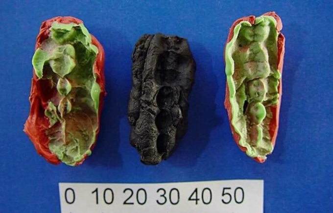 10,000-year-old chewing gum samples discovered in Sweden. Photo: ATI