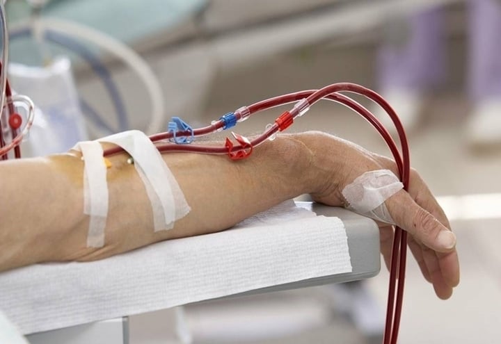 Hemodialysis is a method of filtering blood plasma with two filters, for seriously ill people. (Illustration photo)