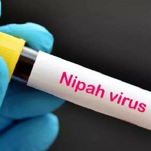 Bangladesh registra la primera muerte por virus Nipah en 2024