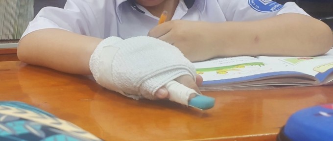 The student's right hand is bandaged. Photo: CP