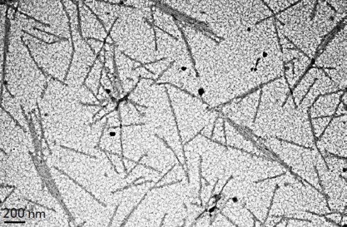 Virus del mosaico del tabaco bajo microscopía electrónica de transmisión (MET). Foto: Research Gate