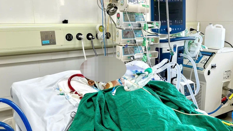 Efforts to save the life of a patient in critical condition with severe pneumonia photo 1