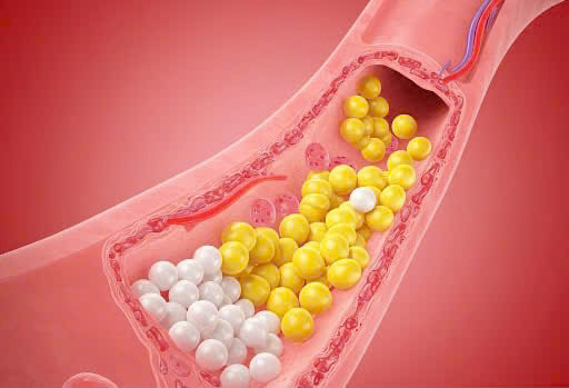 Những món tiếp khách ngày tết không ngờ giảm cholesterol, ngừa đau tim cực hay- Ảnh 2.