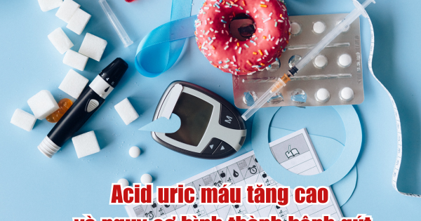 Acid uric máu tăng cao và nguy cơ hình thành bệnh gút