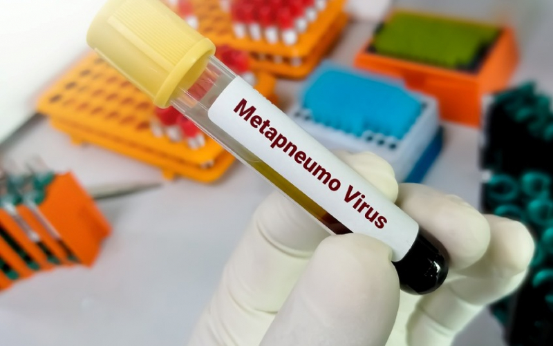 Be vigilant, but don't panic about respiratory disease caused by HMPV-1 virus