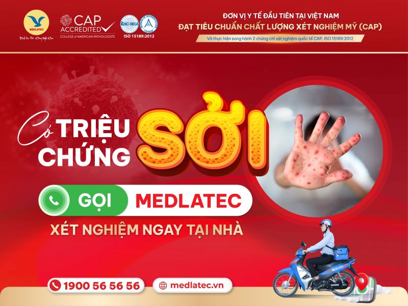 Lựa chọn dịch vụ xét nghiệm tận nơi tiện lợi và chất lượng của MEDLATEC