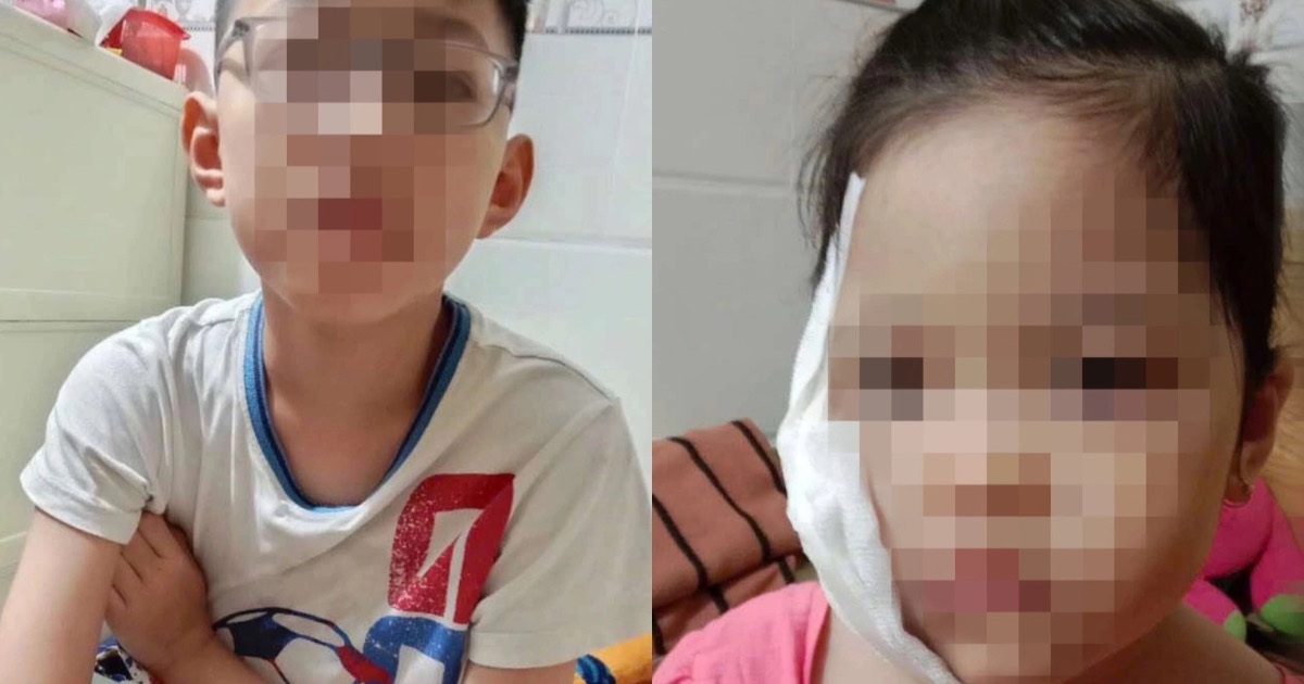 Two children in Binh Duong were hit by fireworks, suffering burns to their faces and hands.