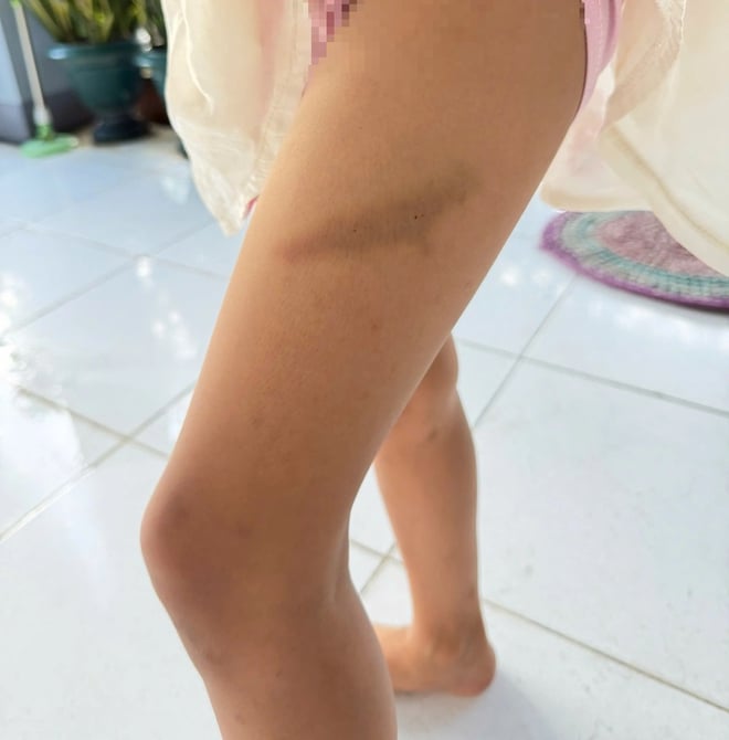 Phụ huynh TP.HCM tố thầy giáo đánh học sinh: Giáo viên nhận sai, trường sẽ giám sát- Ảnh 4. Phụ huynh TP.HCM tố thầy giáo đánh học sinh: Giáo viên nhận sai, trường sẽ giám sát- Ảnh 4.