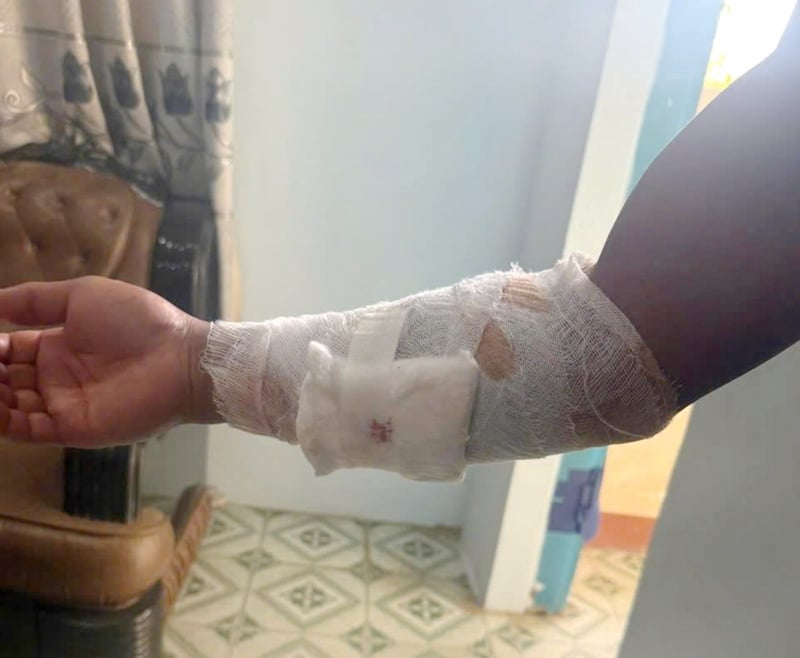 Beim Angeln am Cho-Fluss wurde ein junger Mann von einem entflohenen Krokodil angegriffen -0