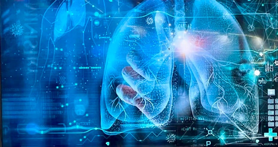 Ứng dụng AI chẩn đoán ung thư phổi giúp tăng cường khả năng phát hiện bệnh - Ảnh 1.
