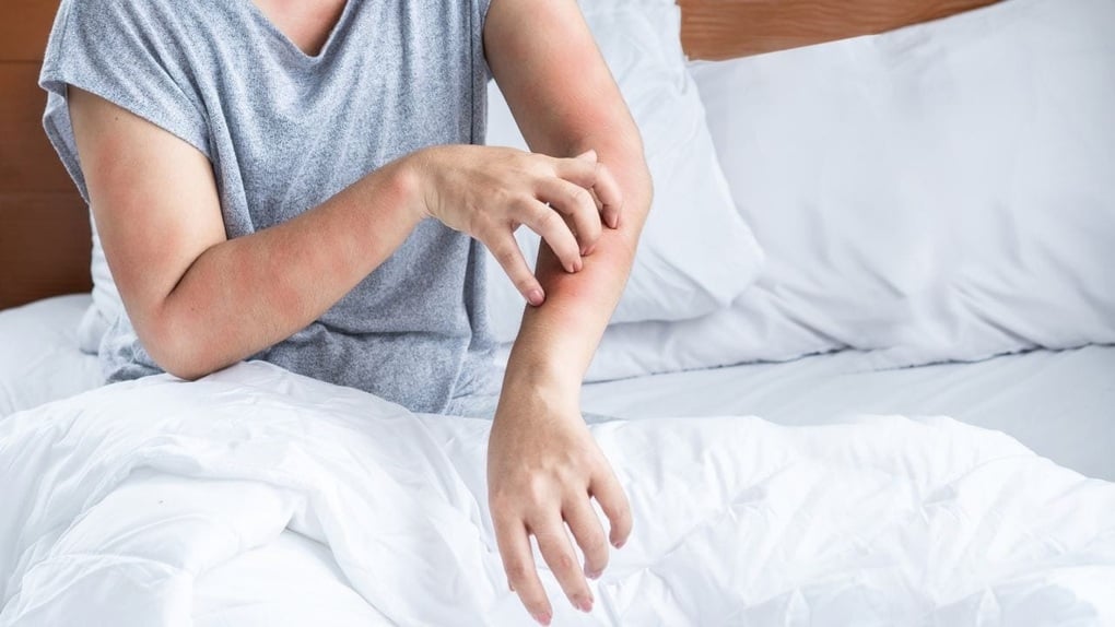 7 dấu hiệu cho thấy thận kêu cứu vào ban đêm - 3
