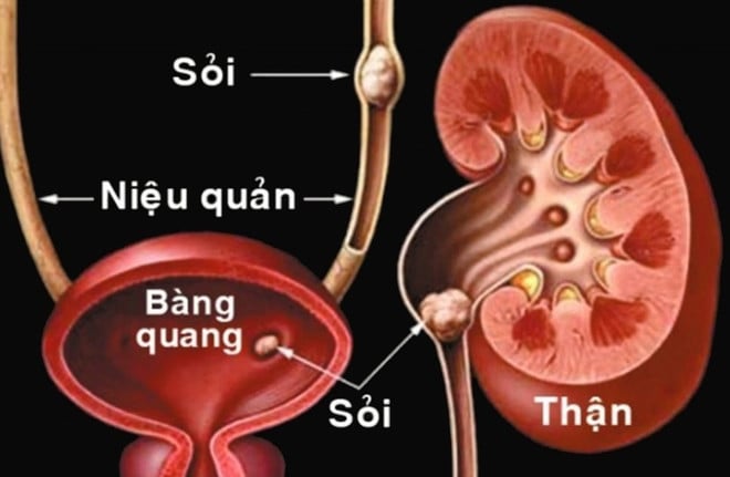 1710-soi-than-3.jpg