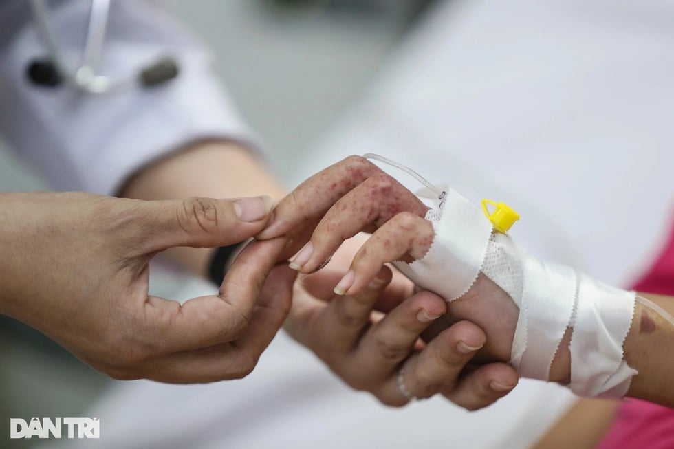 Nguy cơ dịch chồng dịch, một bệnh viện ở TPHCM sẵn sàng mở rộng giường bệnh - 5