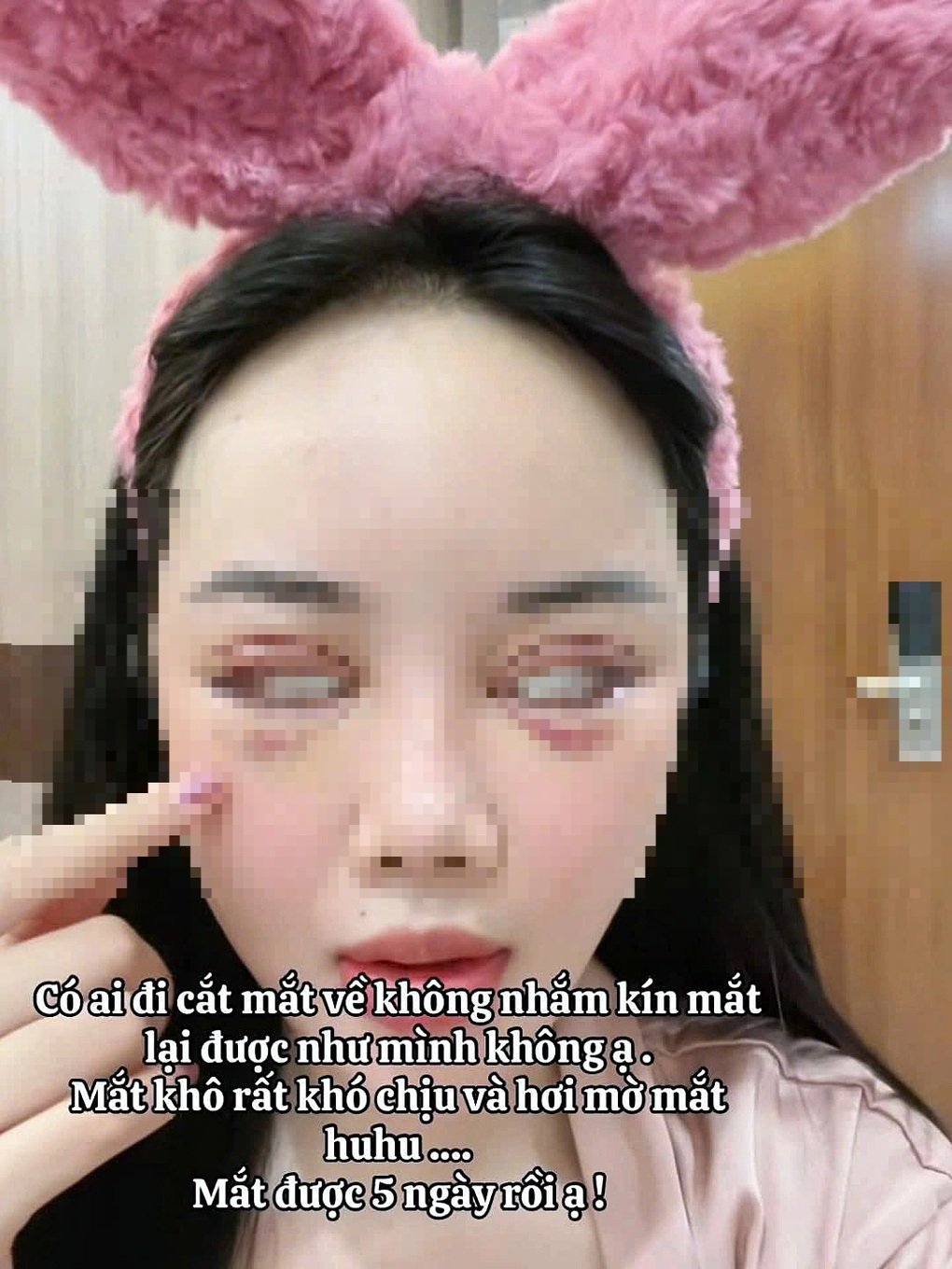 Cắt mí 5 ngày không nhắm được mắt, bác sĩ cảnh báo nguy cơ - 1