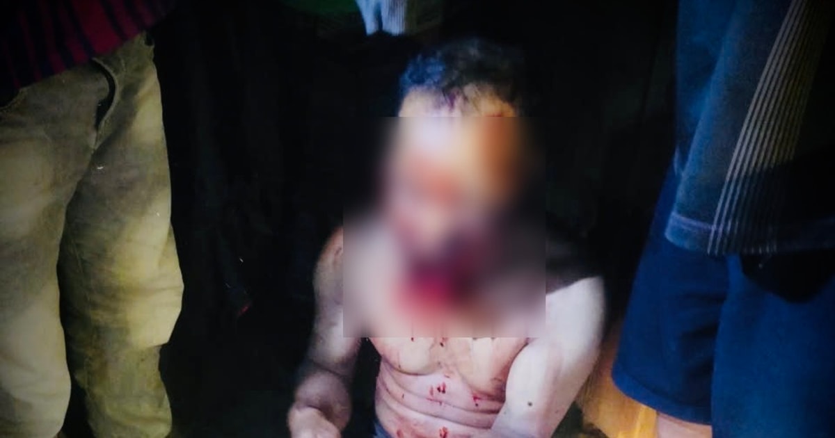 Một trưởng thôn người Cơ Tu bị gấu tấn công trên đường đi làm về nhà