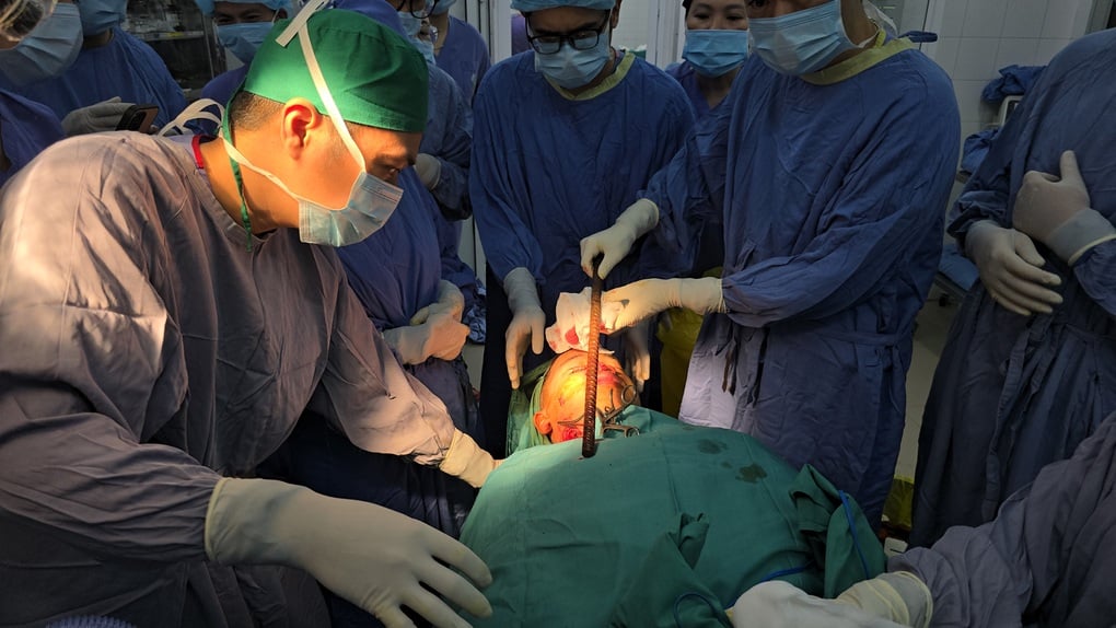 Nam sinh 16 tuổi bị thanh sắt dài 3m đâm xuyên từ đầu qua gáy - 1