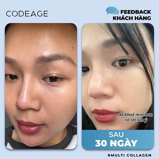 Tác dụng của collagen trong việc làm đẹp khiến phụ nữ 30+ ‘yêu’ hơn cả skincare high-end- Ảnh 9. Tác dụng của collagen trong việc làm đẹp khiến phụ nữ 30+ ‘yêu’ hơn cả skincare high-end- Ảnh 9.