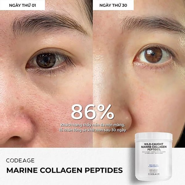 Tác dụng của collagen trong việc làm đẹp khiến phụ nữ 30+ ‘yêu’ hơn cả skincare high-end- Ảnh 11. Tác dụng của collagen trong việc làm đẹp khiến phụ nữ 30+ ‘yêu’ hơn cả skincare high-end- Ảnh 11.