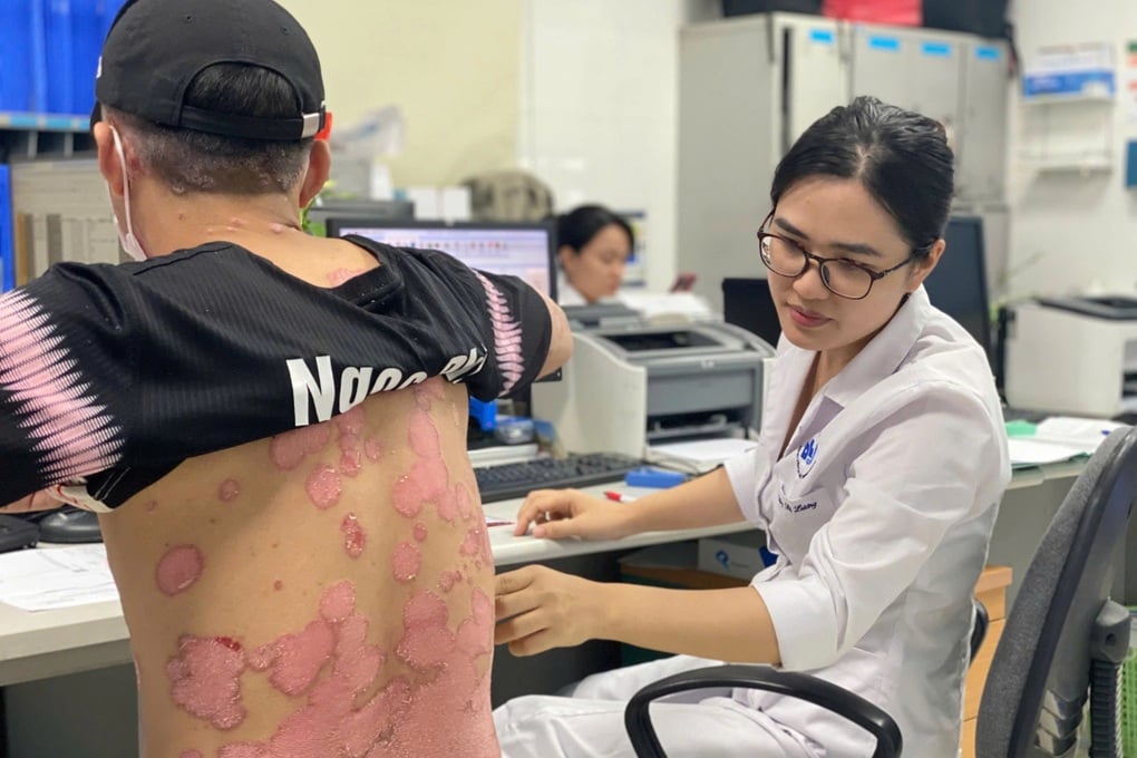 2 triệu người Việt mắc căn bệnh bong tróc da toàn thân - 2