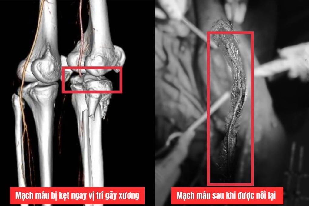 Bác sĩ chạy đua với thời gian, giúp chàng trai thoát cảnh phải cắt chân - 2