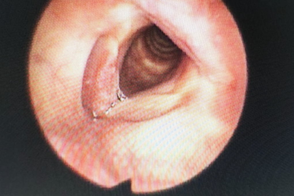 TPHCM: Phát hiện ca bệnh hiếm gặp, mắc cùng lúc 2 loại ung thư  - 1