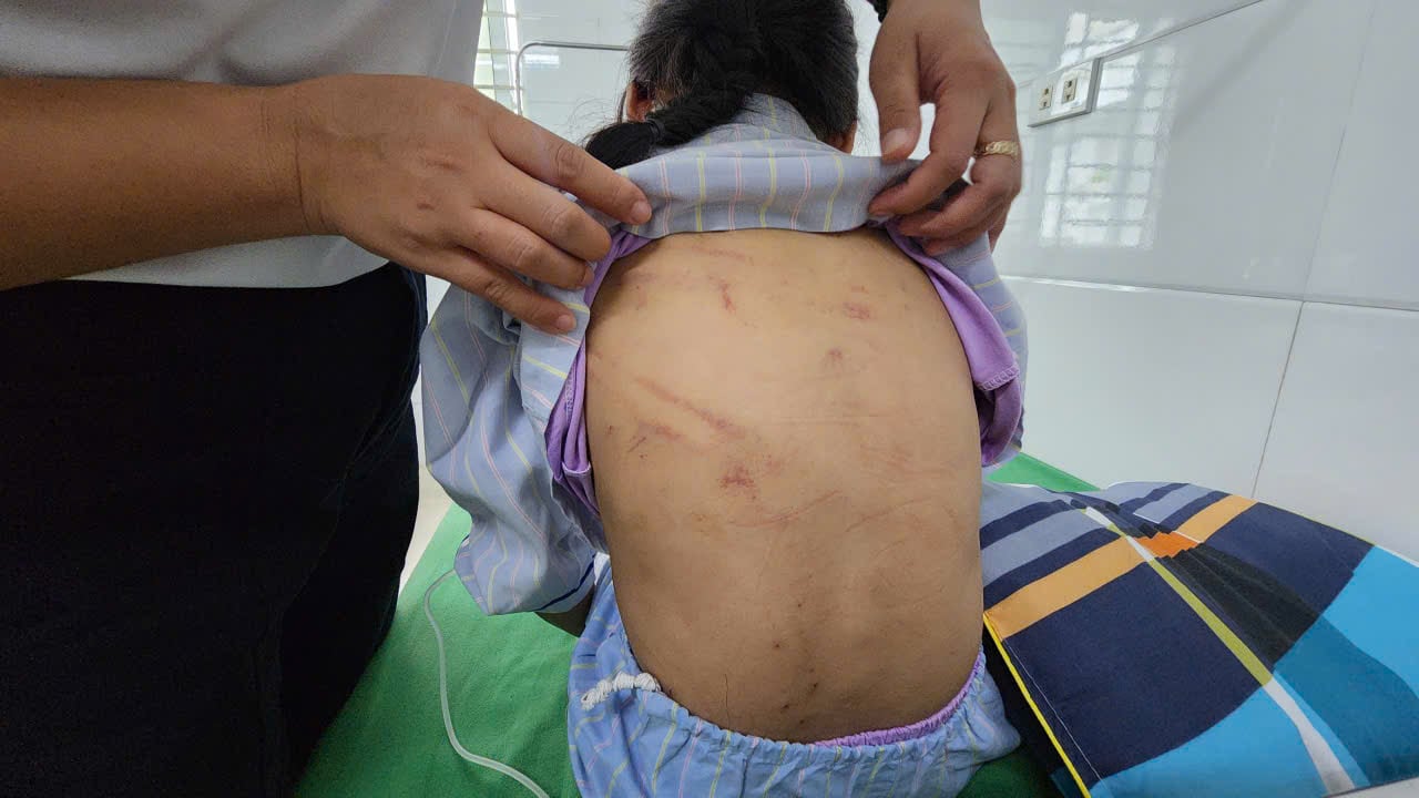 Vụ bé gái ở Hà Tĩnh bị bạo hành: 'Bố dùng búa đánh con...'- Ảnh 3.