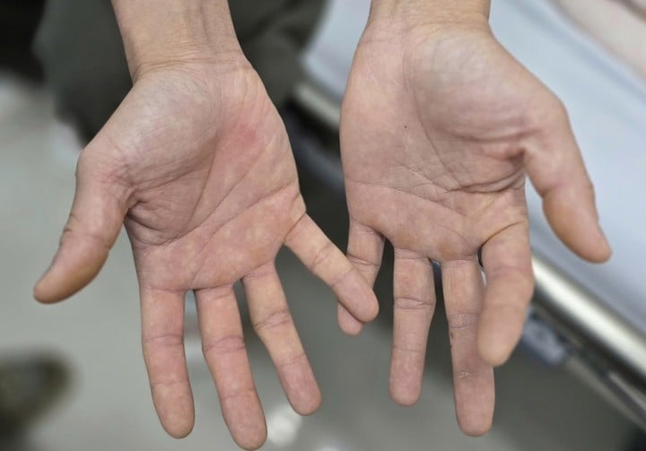 A férfi kezei elzsibbadtak és semmit sem éreztek.