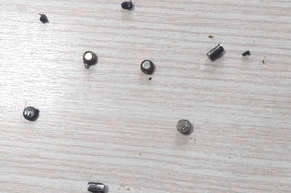 Bé trai 4 tuổi bị thủng ruột vì nuốt 10 cục pin và nam châm - 1