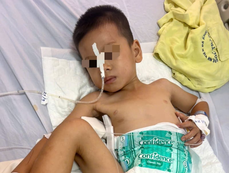 4-year-old boy in Can Tho swallowed 10 batteries and magnets -0