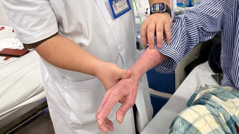 របួសរបស់អ្នកជំងឺ។