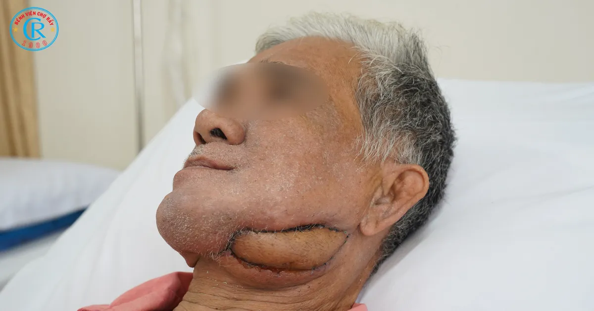 Phẫu thuật tạo hình giúp người bệnh thoát khỏi mặc cảm