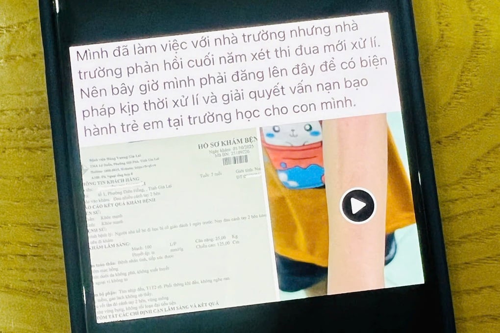 Phụ huynh tố giáo viên dạy dỗ học sinh quá tay - 1