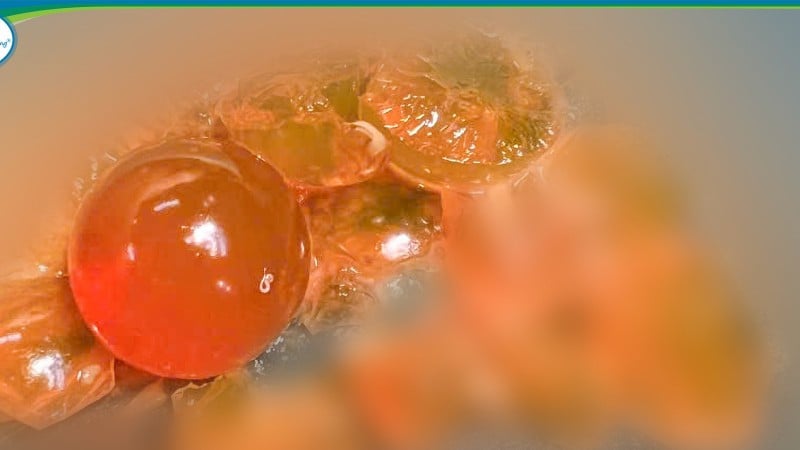 De främmande föremål som avlägsnas är små plastpärlor som kan expandera när de utsätts för vatten.