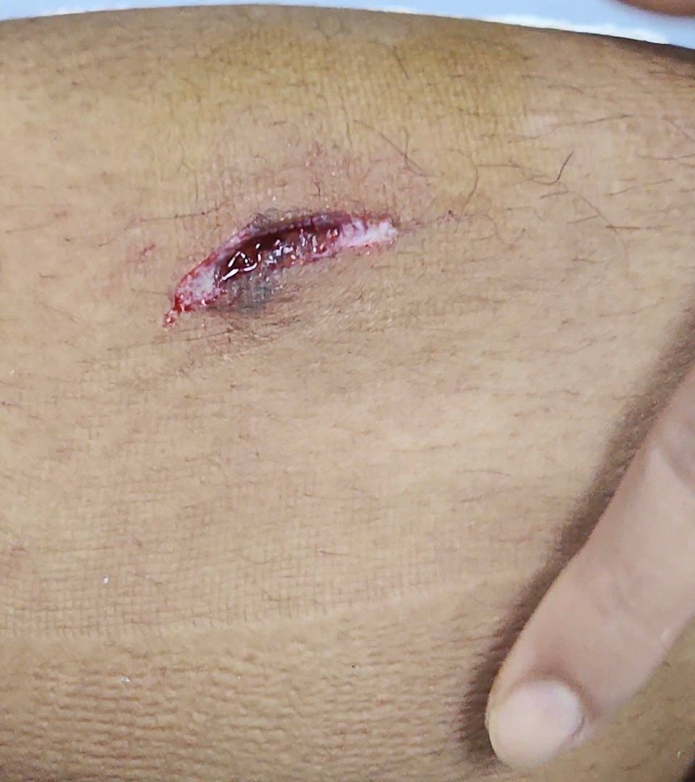 Trần Thành Trung chỉ bị khâu 5 mũi, vẫn kịp đá SEA Games 33: Thầy Kim thót tim- Ảnh 3.