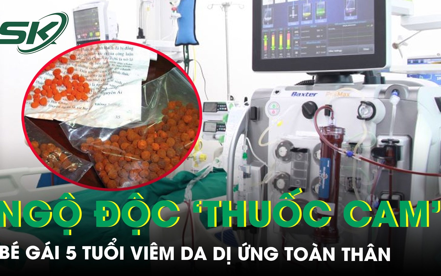 Xót xa bé gái 5 tuổi viêm da dị ứng toàn thân sau 7 ngày bôi và uống ‘thuốc cam’ 