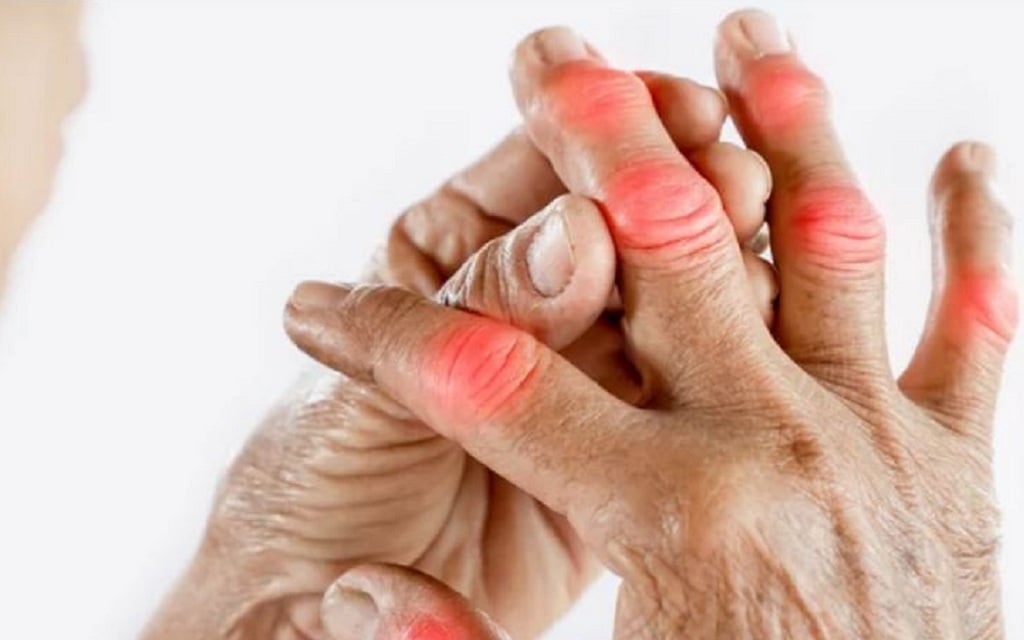 Bị viêm khớp nên ăn gì, kiêng gì?