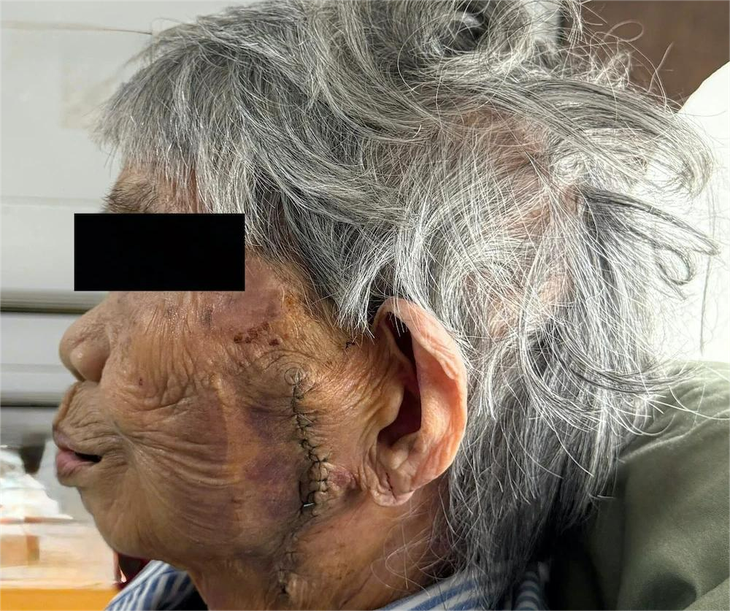 ung thư - Ảnh 1.