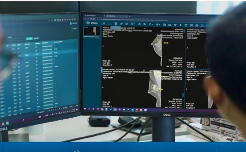 Việt Nam có sản phẩm AI chẩn đoán X-quang tuyến vú được FDA công nhận - Ảnh 1.