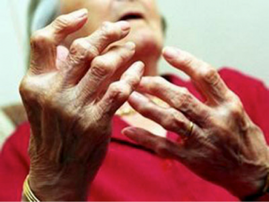 Ngũ gia bì trị phong thấp, chấn thương đụng giập