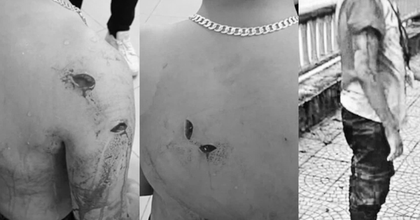 Điều tra vụ học sinh lớp 8 bị bạn dùng vật nhọn đâm rồi hất xuống hồ