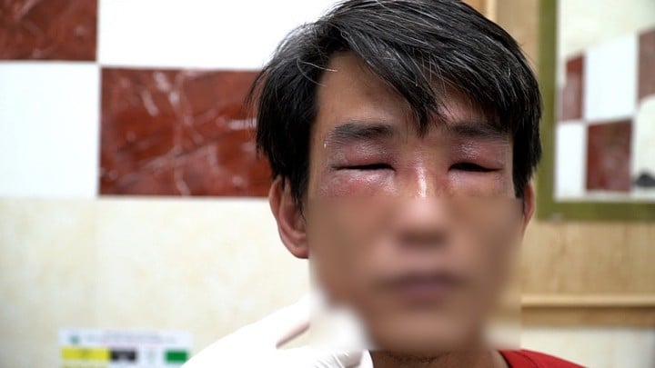 A bársonyhangya mérge kiterjedt, fájdalmas sebeket okozhat.