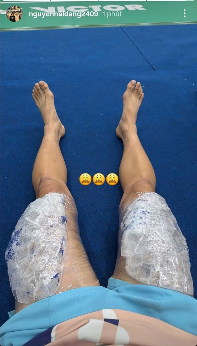 Jucătoarea de tenis Nguyen Hai Dang a făcut incredibilul la turneul de badminton Coreean Masters din 2025 - Fotografia 2. Tay vợt Nguyễn Hải Đăng làm điều khó tin tại giải cầu lông Hàn Quốc Masters 2025- Ảnh 2.