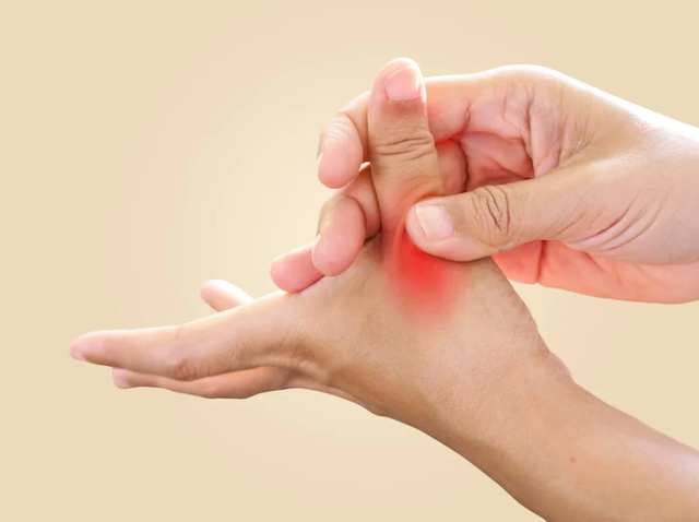 Tê đau ngón tay cái, cô gái bất ngờ phát hiện căn bệnh hiếm gặp- Ảnh 1.
