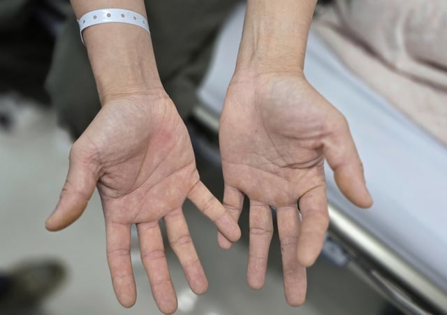 Đứng dậy là ngã, sau thời gian dài hít bóng cười - Ảnh 1.