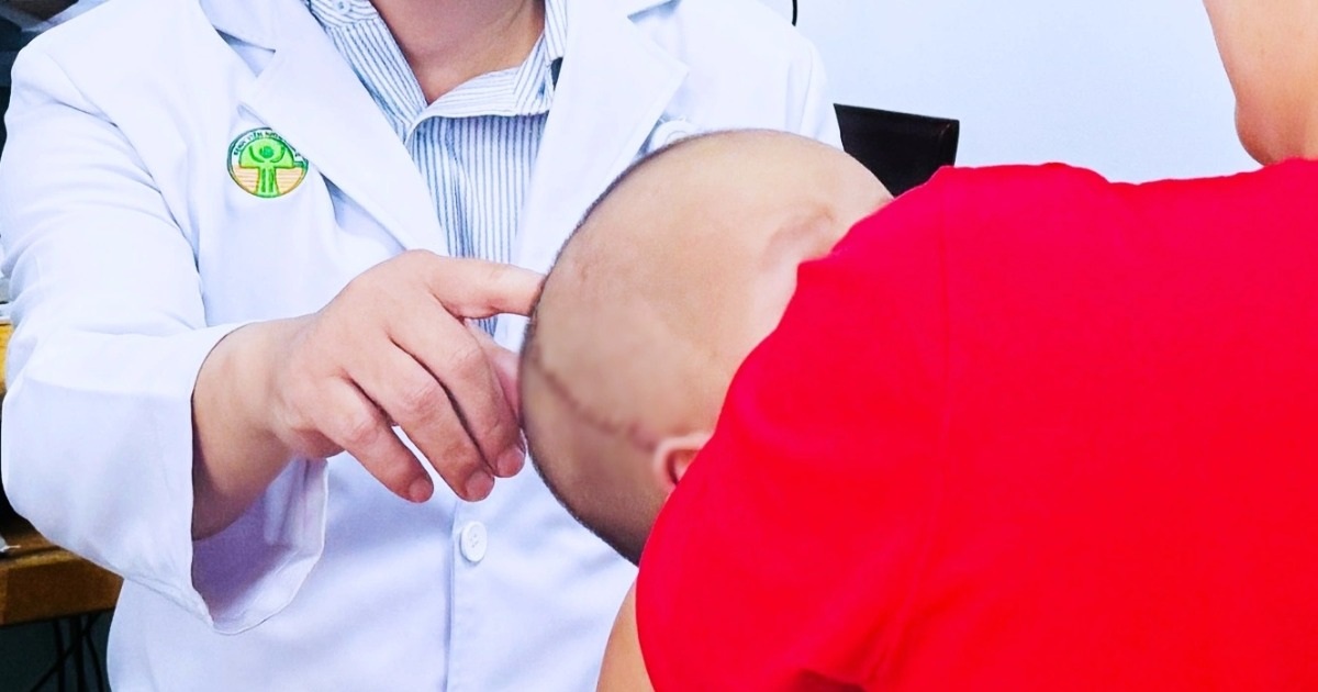 Căn bệnh khiến bé trai ở TPHCM bỗng méo đầu sau sinh, phải mổ sọ não